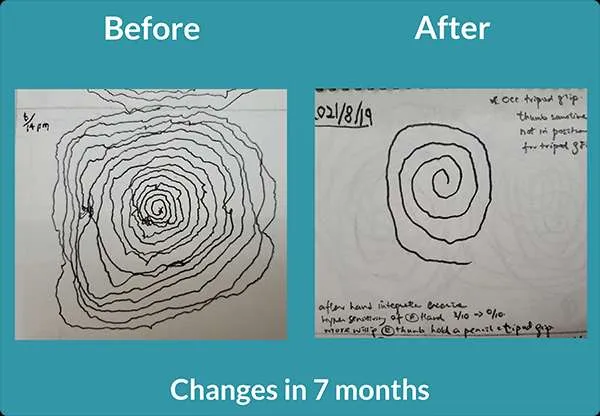 Two spiral drawings showing improvements from before to after.