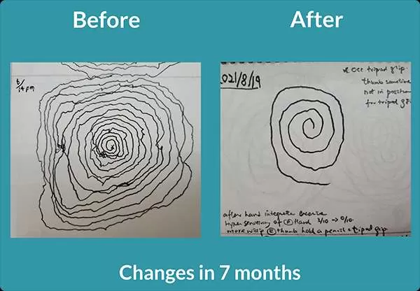 Two spiral drawings showing improvements from before to after.