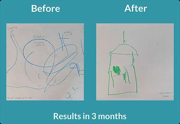 Before-and-After drawings showing improvement in fine motor skills--from scribbles to a picture of a house. Text: Results in 3 months.