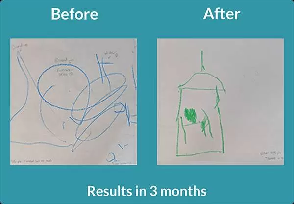 Before-and-After drawings showing improvement in fine motor skills--from scribbles to a picture of a house. Text: Results in 3 months.