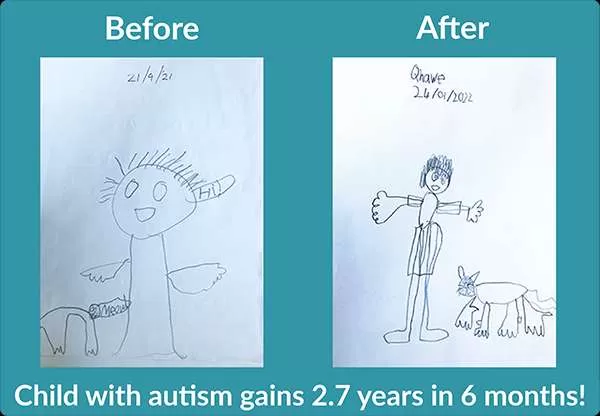 Two drawings of person with dog showing improved fine motor. Text: Child with autism gains 2.7 years in 6 months.