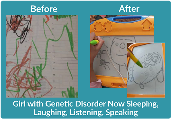 Before-and-After drawings showing improvement in fine motor skills. Text: Girl with Chiari Disorder now sleeping, laughing, listening, speaking