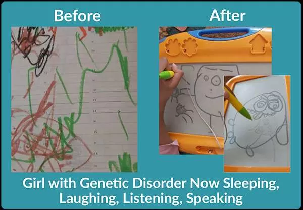 Scribbled drawing and drawing with clear shapes. Text: Girl with Genetic Disorder Now Sleeping, Laughing, Listening, Speaking