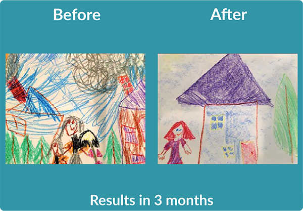 graphic showing two side by side drawings with improvements in drawing for girl with Selective Mutism who was helped by innate rhythmic movements 