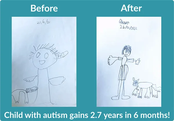 Before and after drawings by autistic child showing large gains in development