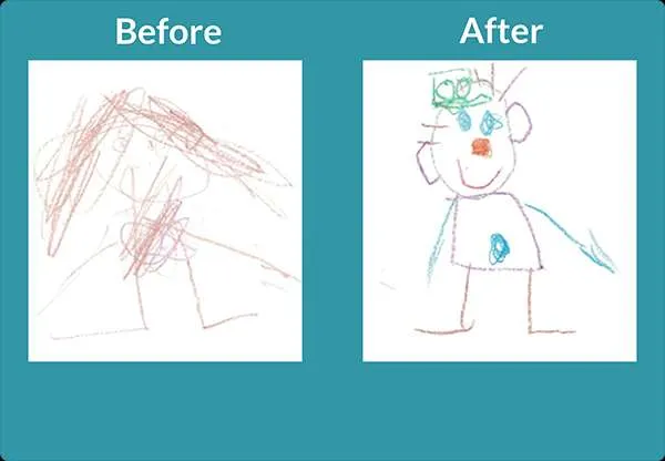 Before and after drawings of people, showing significant fine motor improvements.