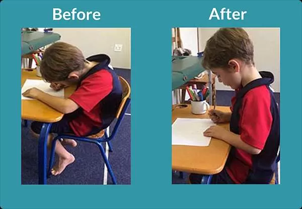 Young boy gets better posture in one session.