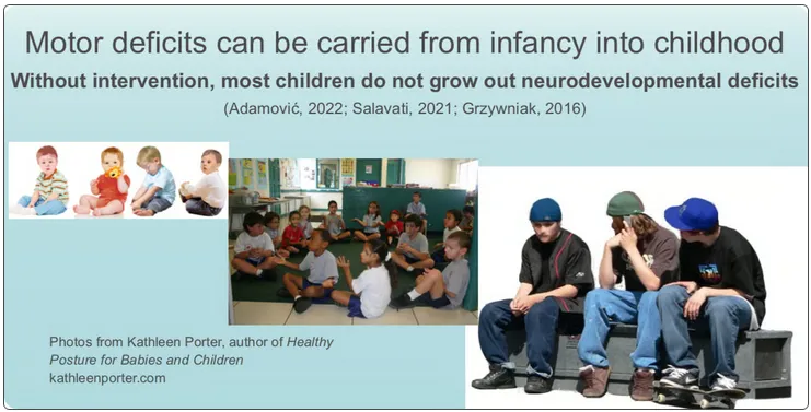 Photographs of infants, children, and teenagers with improper posture. Text: Moto deficits can be carried from infancy into childhood.