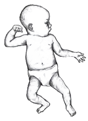Infant in Asymmetrical Tonic Neck Reflex (ATNR) position. Right awm bent with fist near head. Right leg bent. Left arm and legs relaxed.