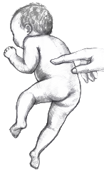Drawing of an infant in prone lifting hip and leg in response to stimulation on the spine by an adult hand.